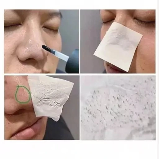 چسب بینی و صورت ضدجوش سرسیاه لانبنا